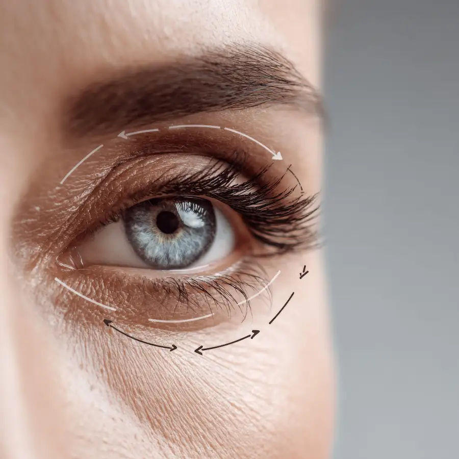 close up of eye Oculoplastic